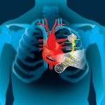Eternal "motor": the energy of the heart can be used to charge pacemakers