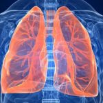Vahvan influenssan takia keuhkoissa voi kasvaa makuhermoja.