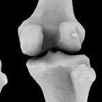 У тілах сучасних людей знайшли зниклу в ході еволюції кістка