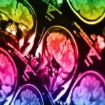 Схильність до суїциду можна виявити за допомогою сканування мозку