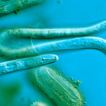 A new species of three-genital worms found in California