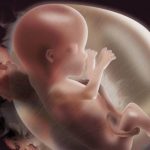 Raskaus raskauden aikana voi vaikuttaa vauvan sukupuoleen