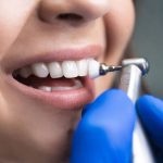 Mitä ovat hammasharjat ja miksi ne eivät riitä oikeaan puhdistukseen?