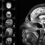 Μπορούν οι σαρώσεις εγκεφάλου να εξηγήσουν την ανθρώπινη συμπεριφορά;