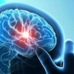 Що таке струс мозку і чим він небезпечний?