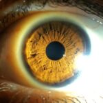 5 хвороб, які можна визначити за станом очей