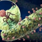 What is phage therapy and can it replace antibiotics?