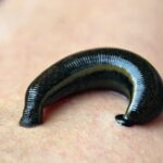 Is Leech Treatment a Useful Therapy or a Waste of Money?