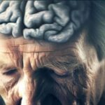 Genetic mutation found that protects against Alzheimer's disease